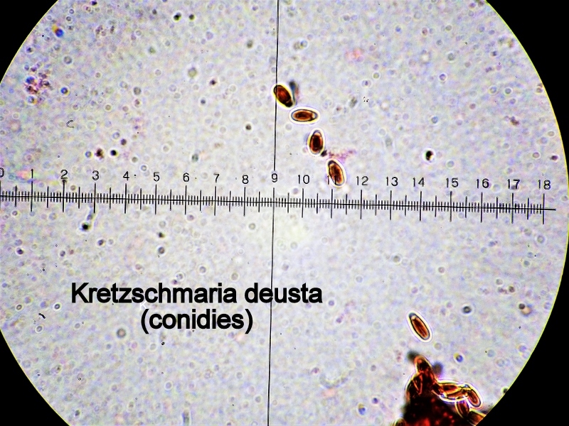 Kretzschmaria deusta-amf1917-conidies.jpg - Kretzschmaria deusta ; Syn1: Ustulina deusta ; Syn2: Hypoxylon deustum ; Nom français: Ustuline brûlée 